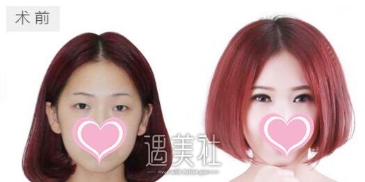 侯亚杰