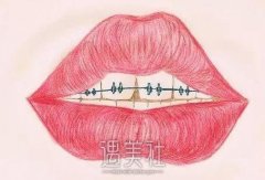 矫正牙齿有年龄限制吗？什么时候做牙齿矫正比较好呢？ width=