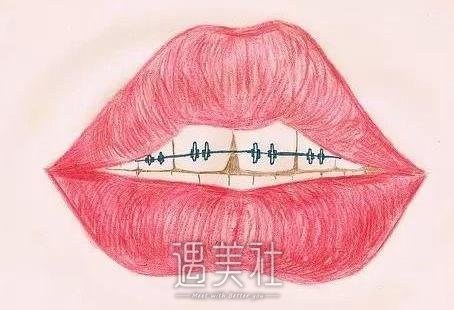 矫正牙齿