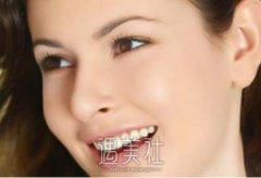 昆明牙齿矫正大致多少钱，是不是很贵喃? width=