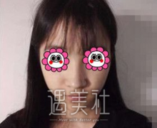 蒋亚楠医生怎么样？有蒋亚楠近期真实案例看看嘛？ width=