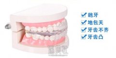 吉林做隐形牙齿矫正的需要多少钱，价格是不是很贵? width=