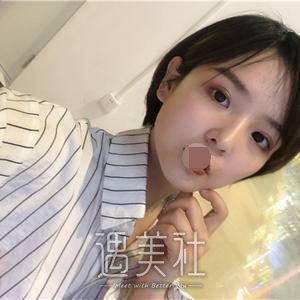 光子嫩肤