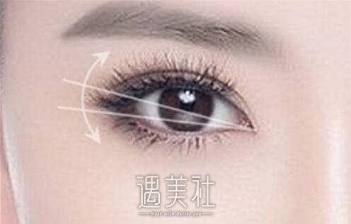 辽宁开外眼角多少钱搞定，什么影响的市场价?
