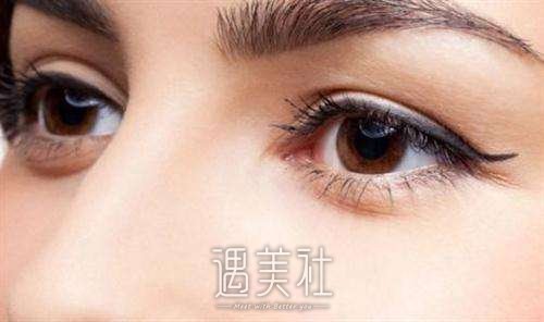辽宁开外眼角多少钱搞定，什么影响的市场价?