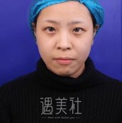 章庆国手术怎么样|章庆国手术案例蠢蠢欲动~ width=