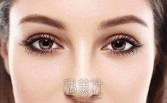 南阳欧式双眼皮大概多少钱，果和价格是不是成正比? width=