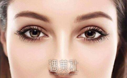欧式双眼皮多少钱