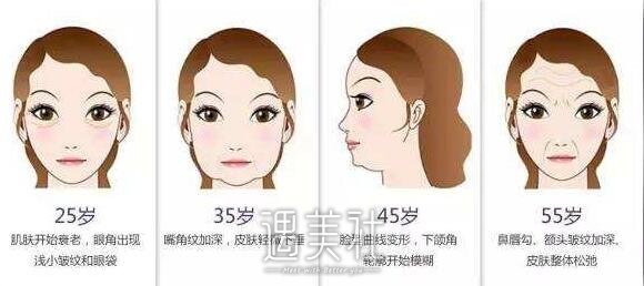 伊维兰