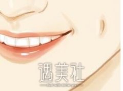 郑州酒窝成形多少钱，除了医院还有哪些影响因素? width=