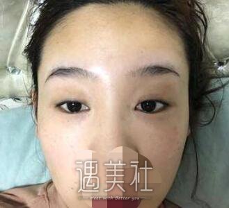 张余光
