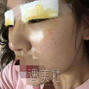 张余光