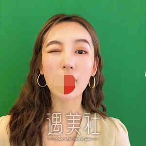 张余光