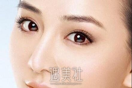 榆林,肿眼泡吸脂