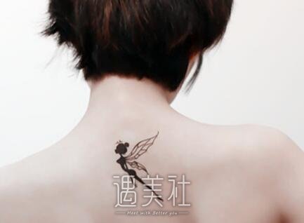 长春,激光洗纹身