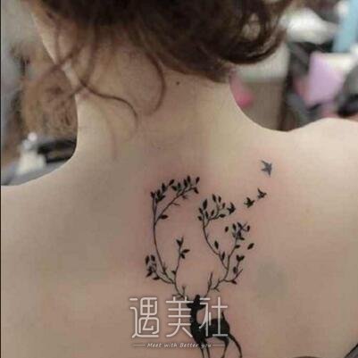 长春,激光洗纹身