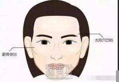 深圳颧骨内推手术价格是多少，听说收费很贵哦? width=