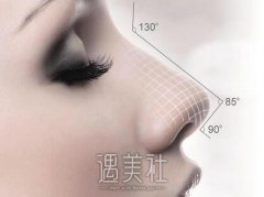 哈尔滨缩鼻翼手术价格是多少，听说价格浮动很大? width=