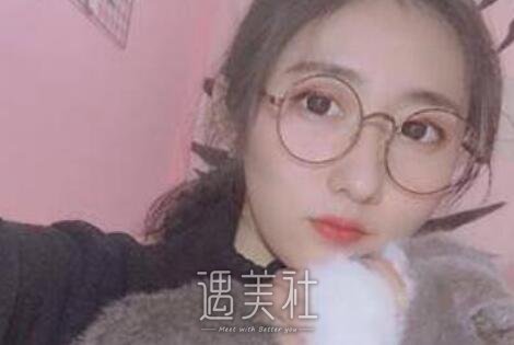 刘珍君,双眼皮