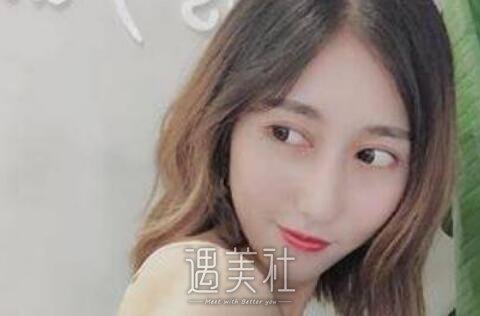 刘珍君,双眼皮