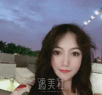 郑京湘,双眼皮