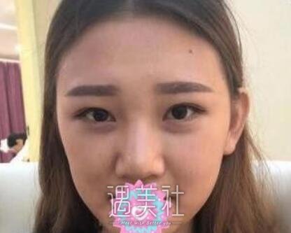 巫文云,鼻子