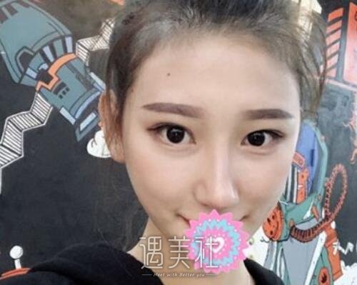 巫文云,鼻子