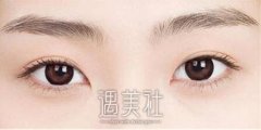 南昌绣眉一般多少钱，听说价格不是很贵? width=