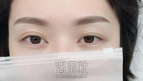 绣眉一般多少钱