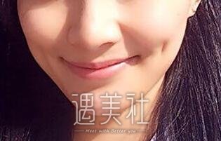 酒窝