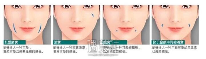 酒窝
