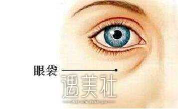 超声法去眼袋