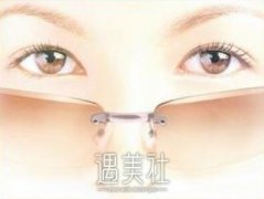 宁波开外眼角贵不贵，多少钱比较合理? width=