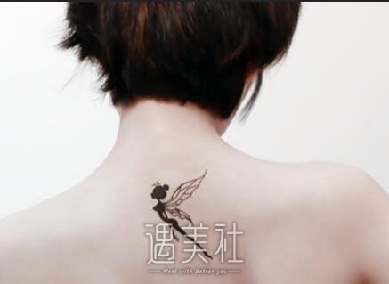 贵阳,激光洗纹身