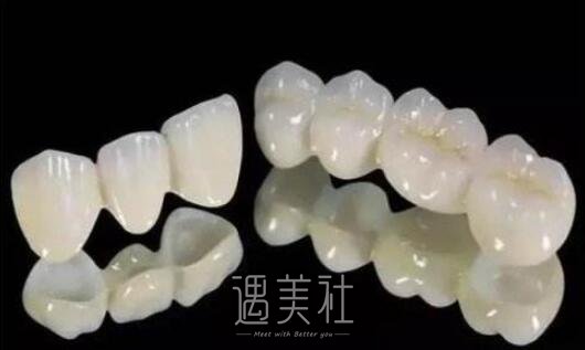 绵阳美容冠矫正龅牙多少钱，听说价格都很贵?