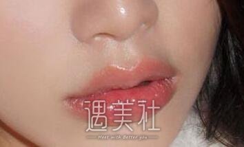 嘴唇整形