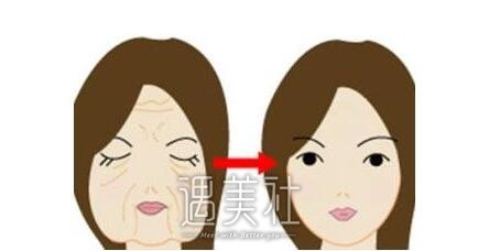 拉皮