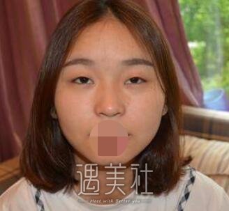 陈辉