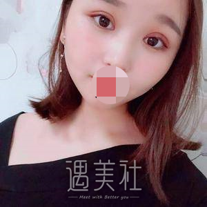 陈辉