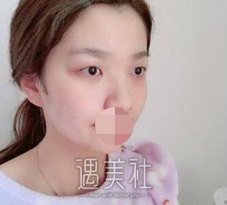李方奇