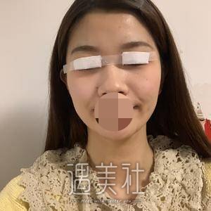 李方奇