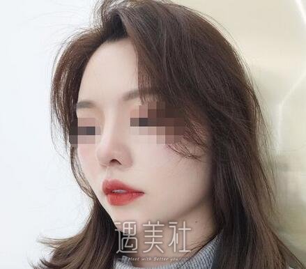 李战强,隆鼻