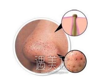 金华做一次黑脸娃娃多少钱，每个人的价格都一样吗?
