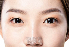 温州整容垫鼻子多少钱，太贵了就做不起呢? width=