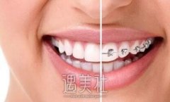 苏州牙博士和美奥哪个好？我还是只有网上查~ width=