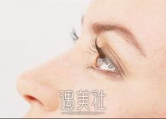 天津朝天鼻矫正价格是多少，哪种价位的好? width=