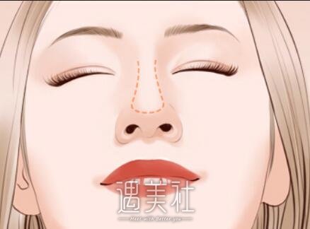 天津,朝天鼻矫正