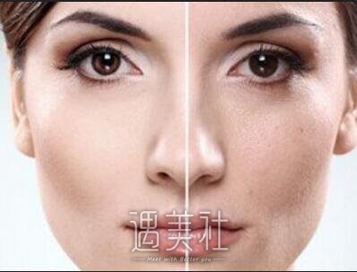 徐州,彩光嫩肤去痘