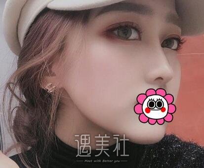 谢洋春,隆鼻