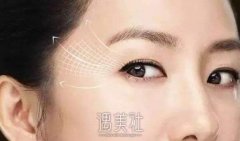 常州激光去鱼尾纹多少钱了，做三次需要的多少钱? width=